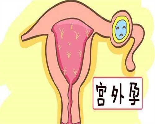 沈阳高龄备孕攻略：卵巢多囊自然怀孕吗？成功率费用避坑指南